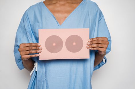Progres în cercetarea rolului hormonilor de estrogen și progesteron asupra dezvoltării cancerului de sân