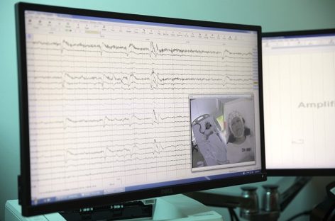 Video-EEG - investigaţie de ultimă generaţie, esenţială în diagnosticul epilepsiei