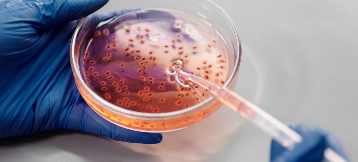 Noi descoperiri care ar putea ajuta la dezvoltarea de tratamente eficace împotriva bacteriilor letale