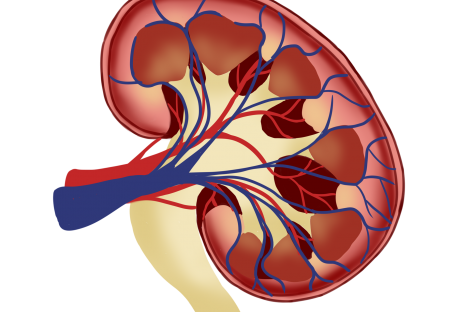 Nou tratament pentru o formă rară de cancer renal, descoperit de cercetători americani