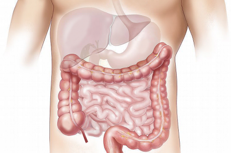 O nouă posibilă ţintă împotriva cancerului colorectal