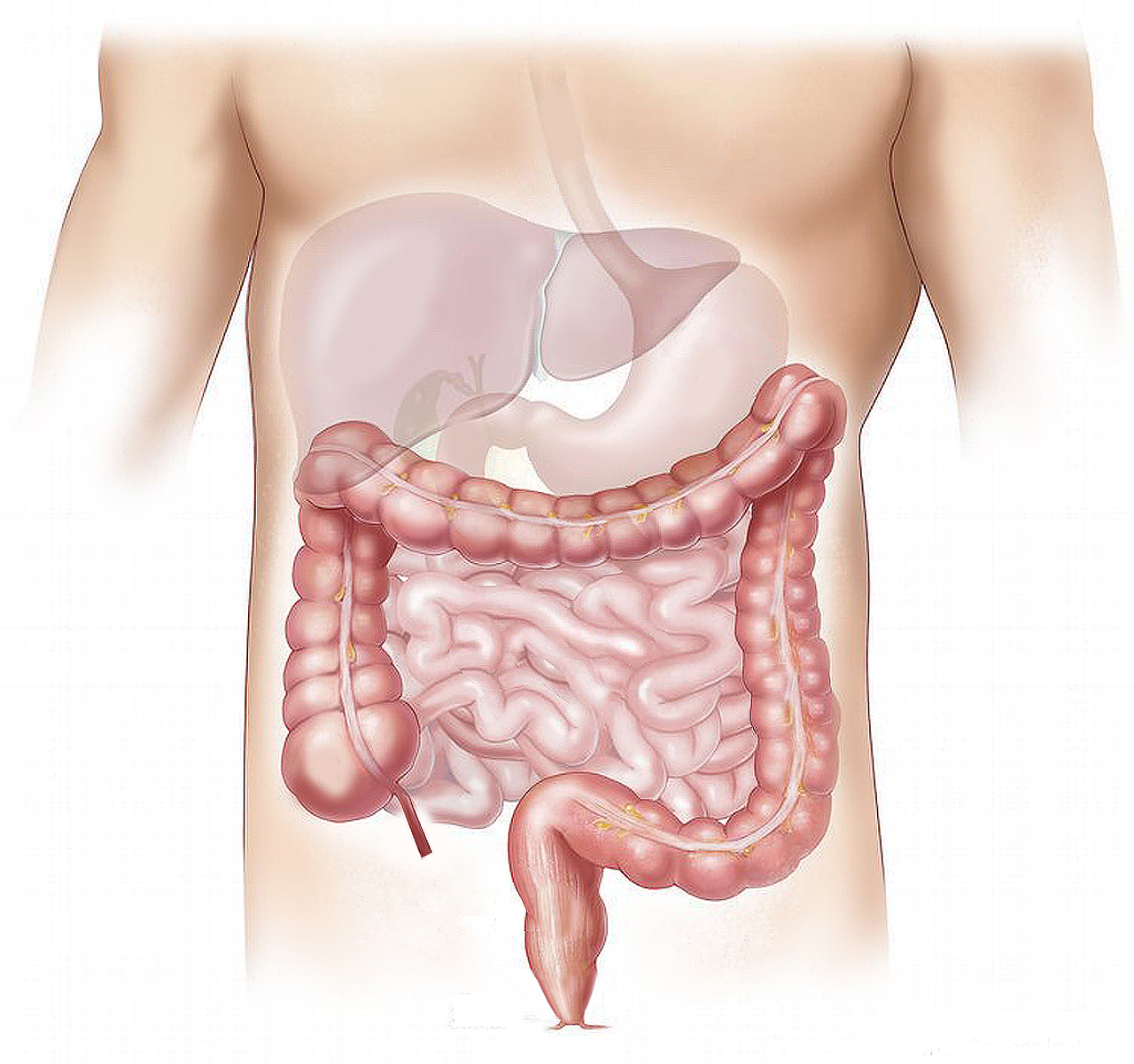 O nouă posibilă ţintă împotriva cancerului colorectal