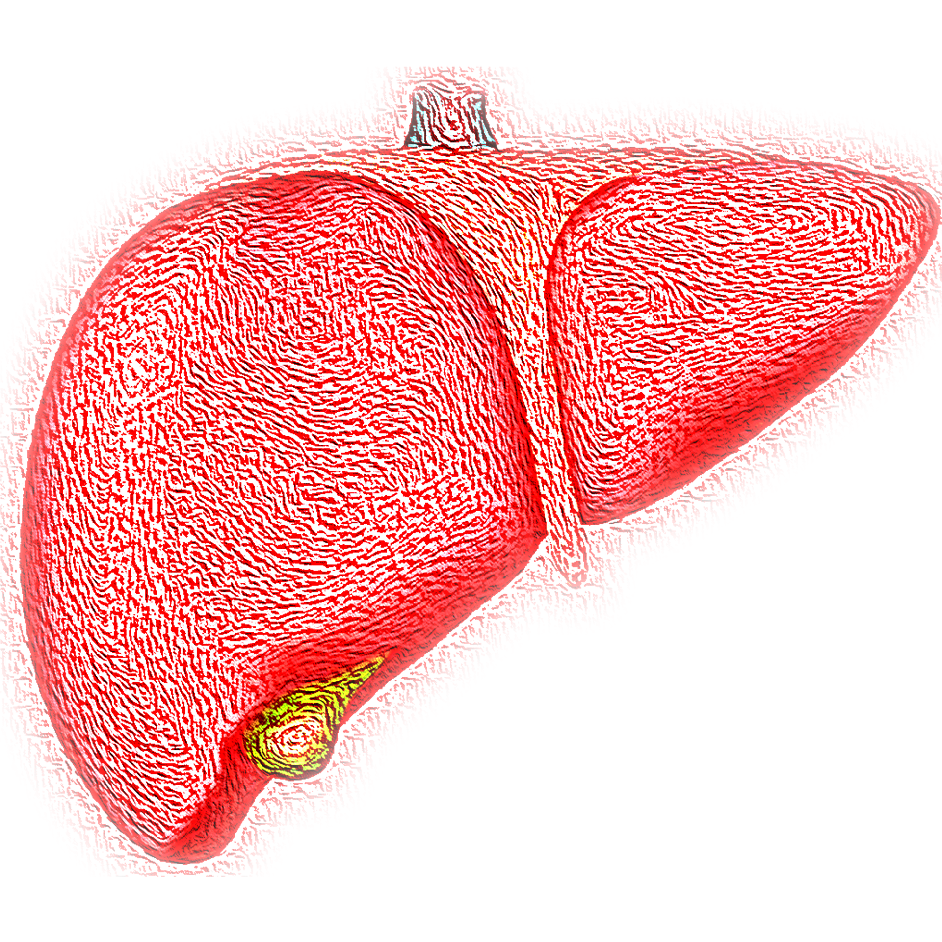 Cercetătorii au identificat ţinta atacurilor imune asupra celulelor hepatice în tulburările metabolice