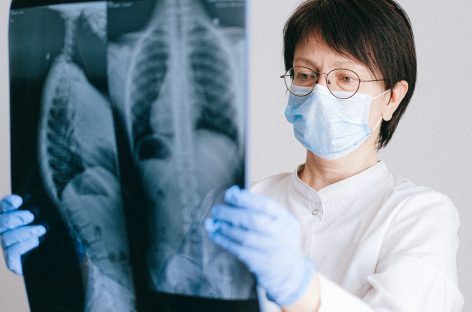 Studiu: Leziuni pulmonare pe termen lung la copiii care s-au vindecat de COVID-19