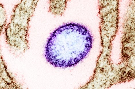 Un nou virus potenţial fatal, descoperit în China