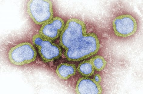 Legătura dintre virusul gripal și alte virusuri comune cu bolile creierului