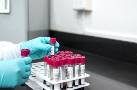 Un test de sânge care poate detecta peste 50 de tipuri de cancer, testat în Marea Britanie