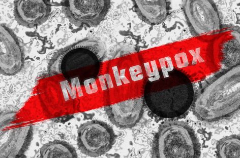 Oficiali OMS: Focarul de variola maimuței poate fi eliminat în Europa