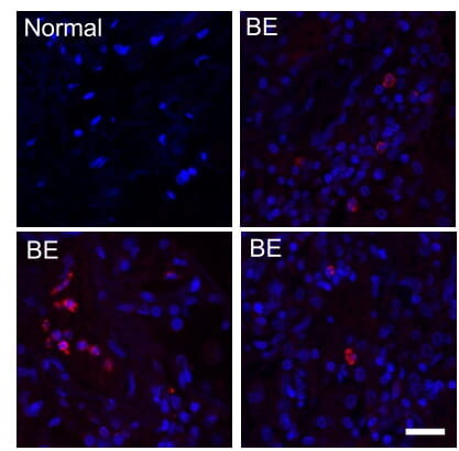 Bacterii considerate inofensive pot agrava bolile pulmonare, indică un studiu internaţional