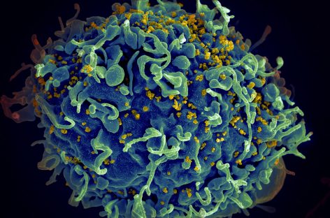 Vaccin împotriva HIV, promițător în studiile preclinice