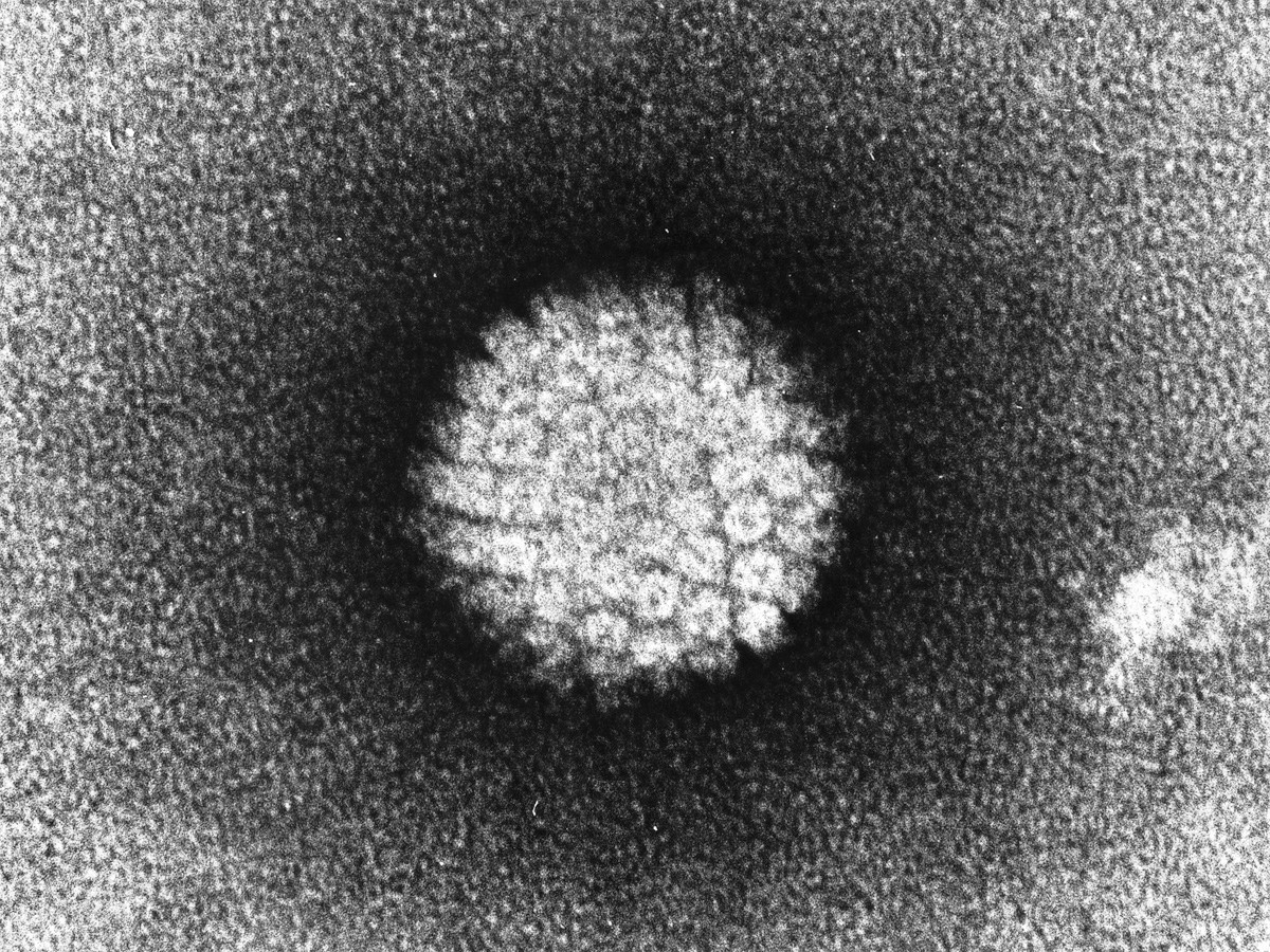 Un nou studiu indică persoanele care se confruntă cu cel mai mare risc de infecţie cu HPV