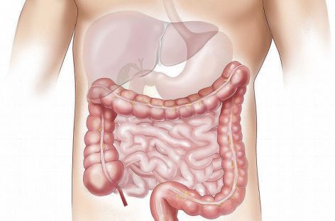 Mecanisme cheie pentru regenerarea mucoasei intestinale şi atenuarea efectelor secundare ale radioterapiei, descoperite de cercetători