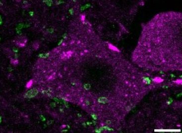 Tratament epigenetic îmbunătățește regenerarea măduvei la șoarecii cu leziuni