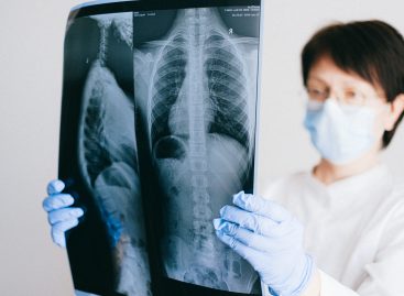 Medicii radiologi solicită limitarea interpretărilor pentru a reduce ratele de eroare