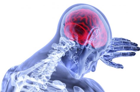 Un biomarker cerebral din analizele de sânge poate indica un AVC viitor, demonstrează un studiu