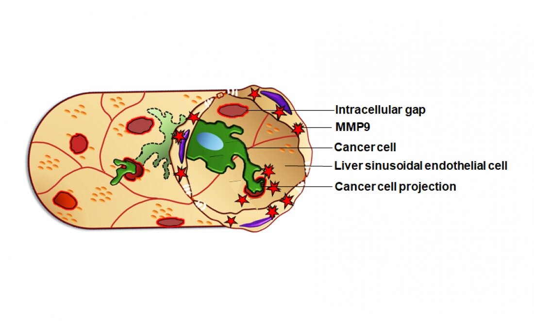 Mecanism folosit de celulele canceroase metastatice pentru a se infiltra în ficat, descoperit de oameni de ştiinţă japonezi