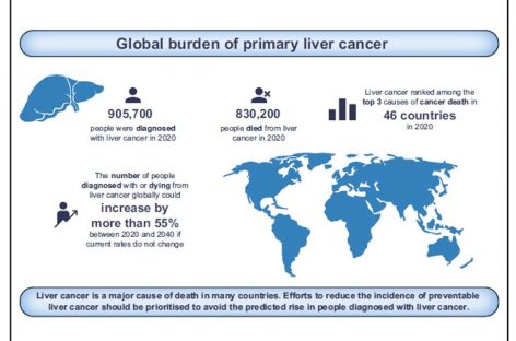 Cazurile de cancer hepatic şi decesele se estimează că vor creşte cu peste 55% până în 2040