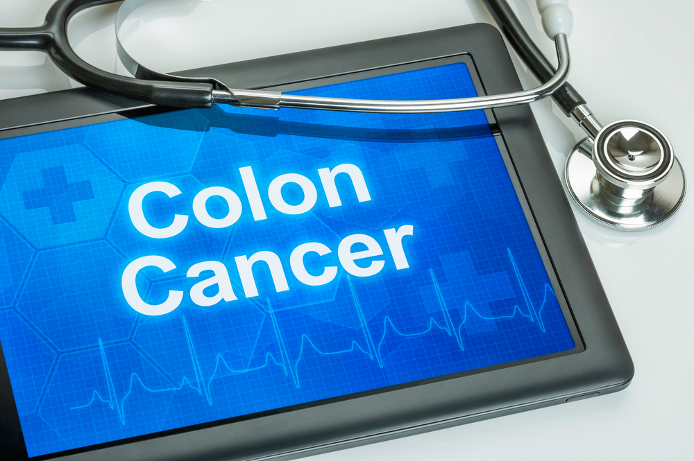 Noi ţinte terapeutice identificate pentru cancerul colorectal