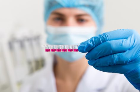 Test de rutină capabil să detecteze pacienții cu risc crescut de cancer de sânge