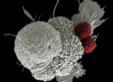 Oamenii de știință au identificat o nouă genă care provoacă cancer de colon