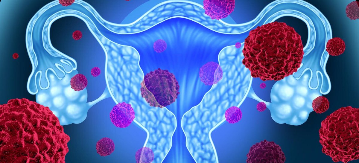 STUDIU: Tratamentul cu tamoxifen, asociat cu un risc crescut de boli și cancere uterine