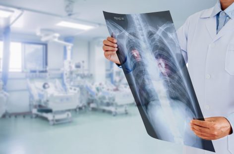 Medicament nou, rezultate promiţătoare împotriva celui mai mortal tip de cancer