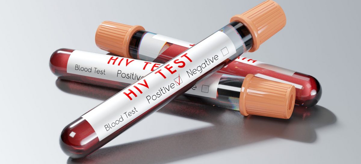 Încă un vaccin anti-HIV suferă un eșec în testele clinice