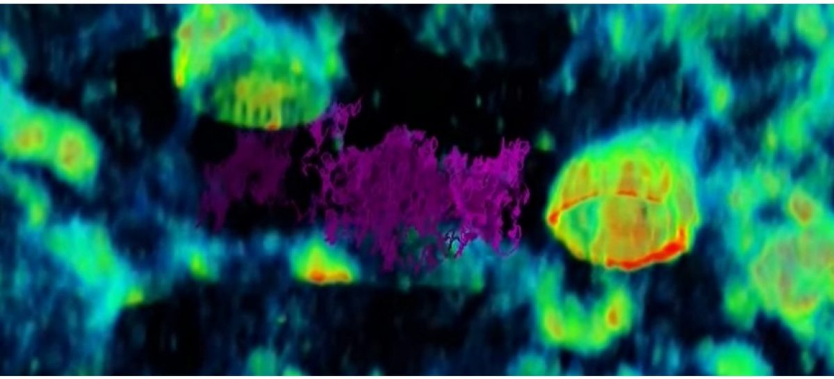 Virus_care vrea să intre în celule Pentru prima dată, un virus e filmat cum „pândește” să intre în celulele umane