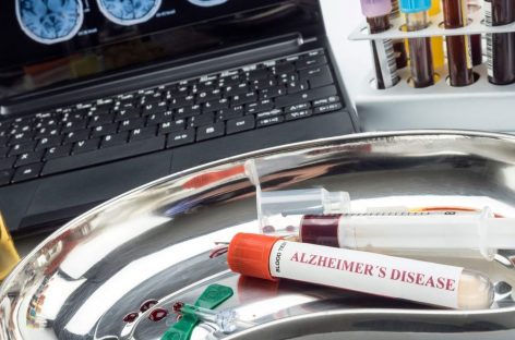 Compania Roche primește undă verde în SUA pentru testele de diagnosticare a maladiei Alzheimer