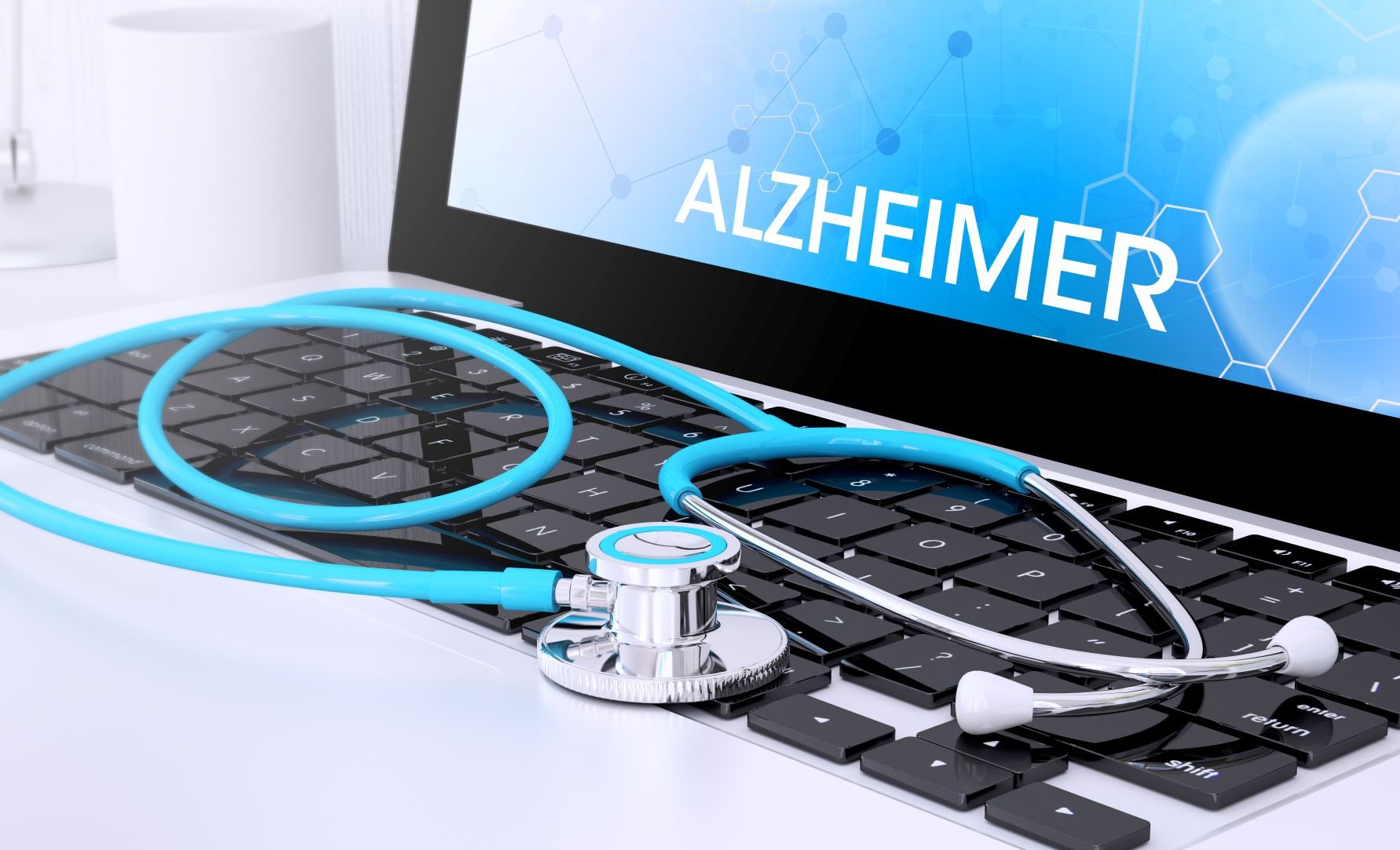 Experţii salută rezultatele obţinute de un medicament împotriva maladiei Alzheimer, dar indică şi efectele adverse