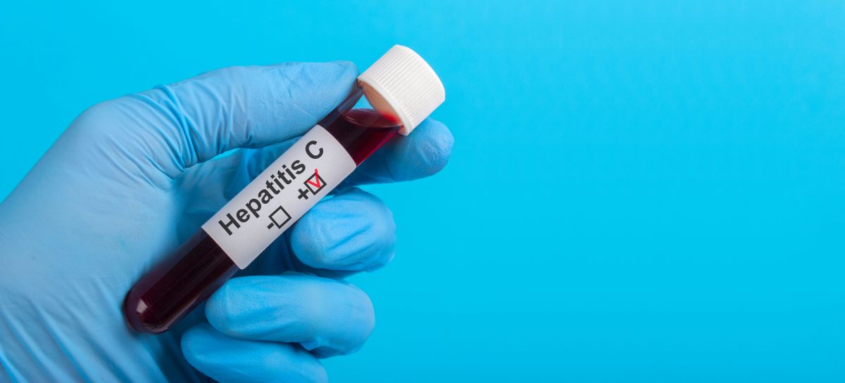 Anglia ar putea deveni prima țară care elimină virusul hepatitei C