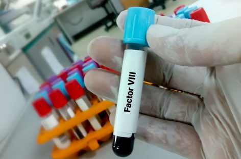 Sanofi își propune să lanseze în 2023 un medicament pentru o afecțiune rară de sânge