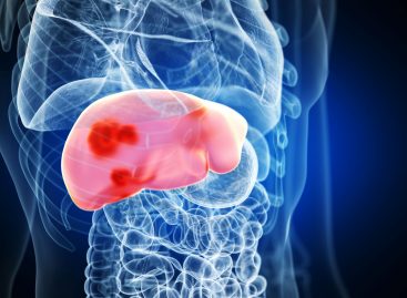 Tratarea cancerului de ficat printr-o nouă abordare