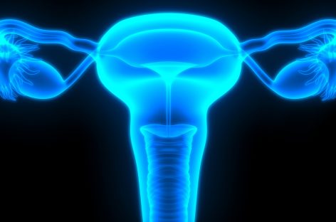 Tratament împotriva cancerului ovarian, autorizat complet în SUA