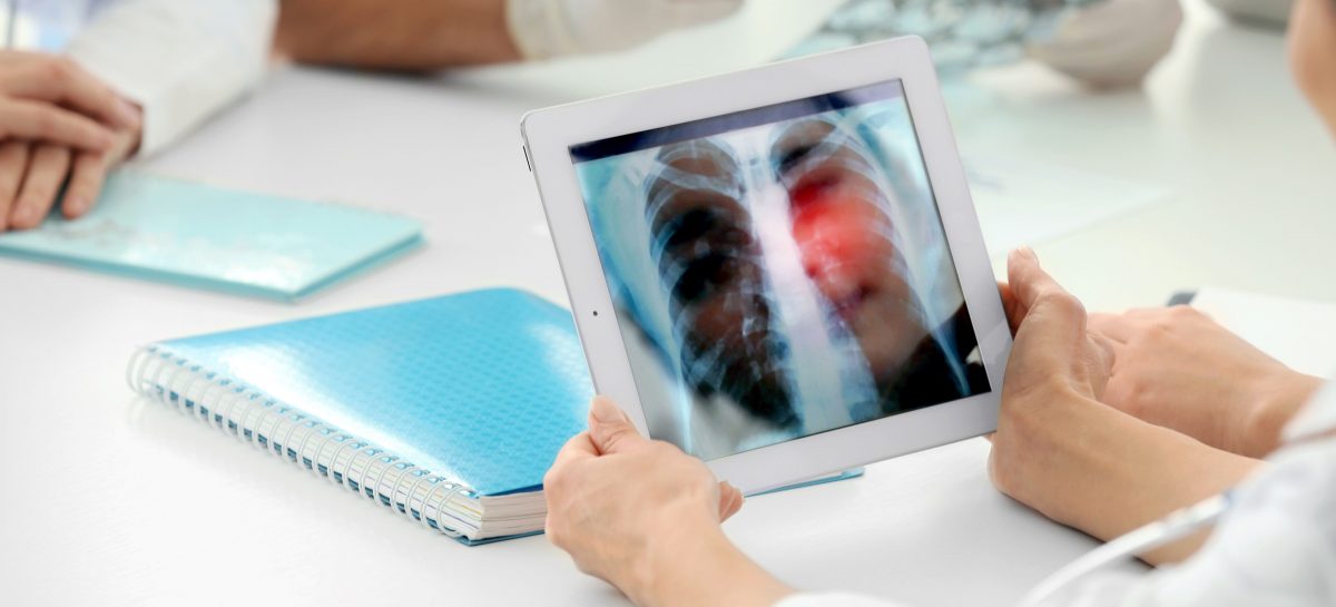 Takeda anunță retragerea de pe piață a unui tratament împotriva cancerului pulmonar
