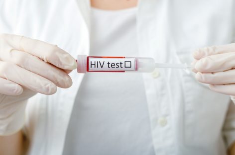 Un tratament experimental împotriva HIV reduce de o mie de ori nivelul virusului în sânge, potrivit unui studiu