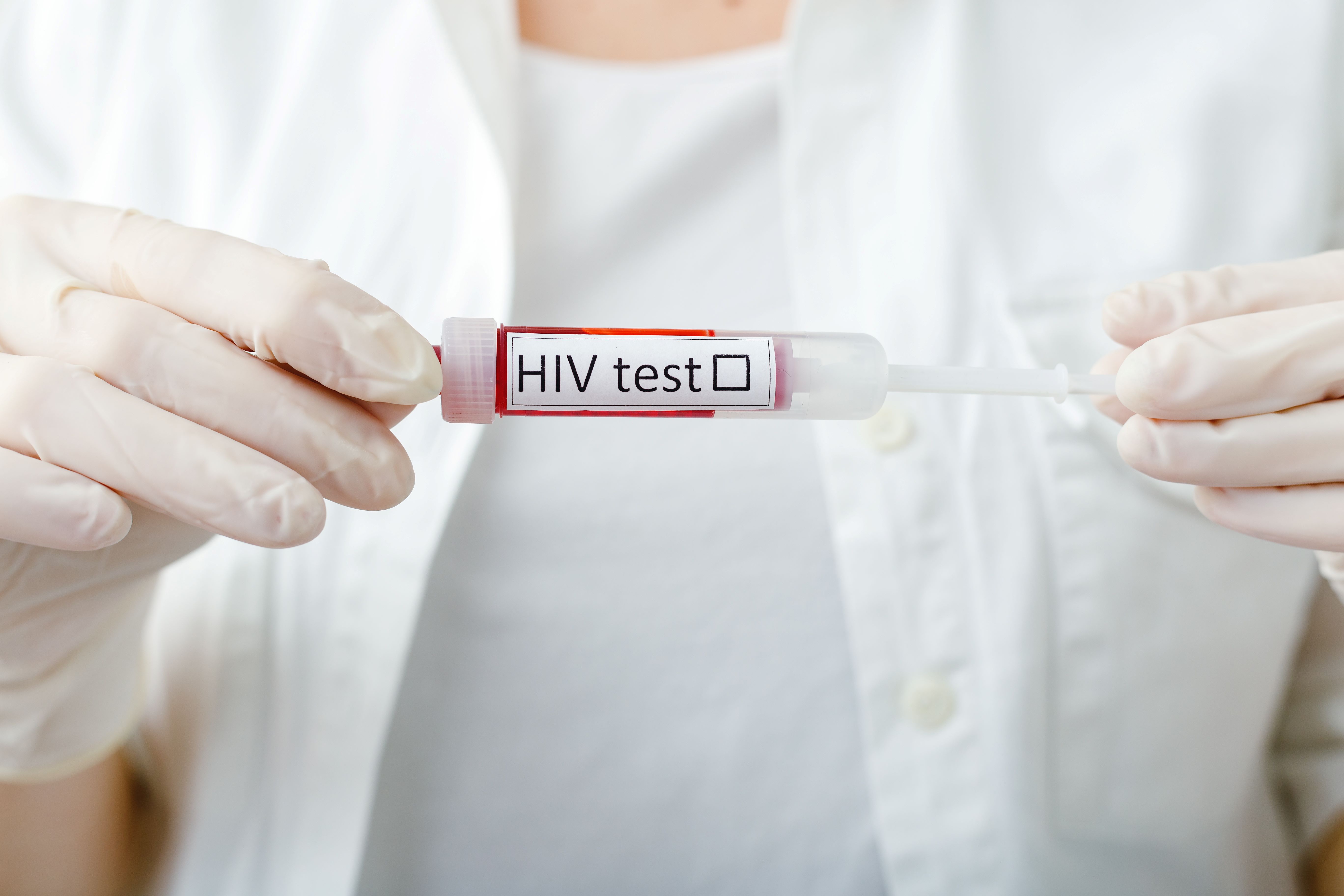 Cercetătorii au reuşit să izoleze un anticorp anti-HIV din celule de alpaca, pentru un nou potenţial tratament împotriva SIDA