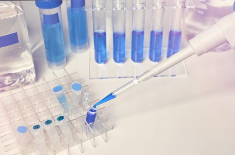 Test PCR ultrarapid, dezvoltat de cercetători