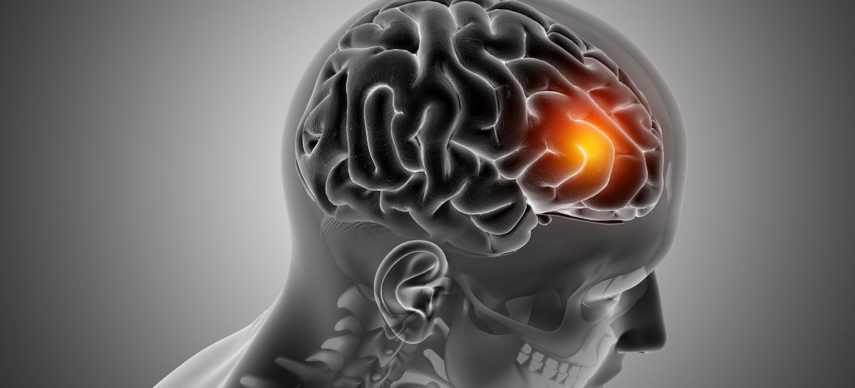 VIDEO Ce este și cum funcționează un implant cerebral uman?