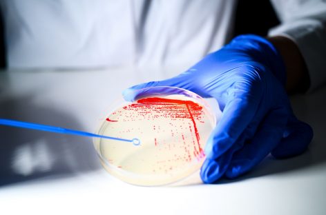 O singură doză dintr-o nouă clasă de antibiotice a eliminat infecţiile rezistente din sânge, în testele preclinice