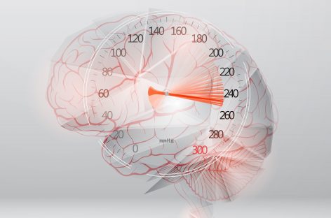 Tensiunea arterială și sănătatea creierului