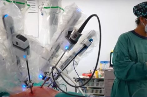 Tehnică de pionierat în Spania: Transplant pulmonar cu ajutorul unui robot cu patru braţe