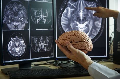 O recentă descoperire a oamenilor de știință furnizează noi indicii pentru prevenirea maladiei Alzheimer