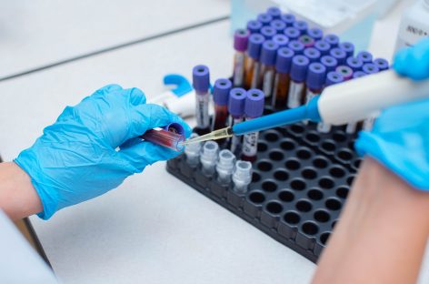 Instrument de predicţie pentru îmbunătăţirea îngrijirii pacienţilor cu cancer din Europa