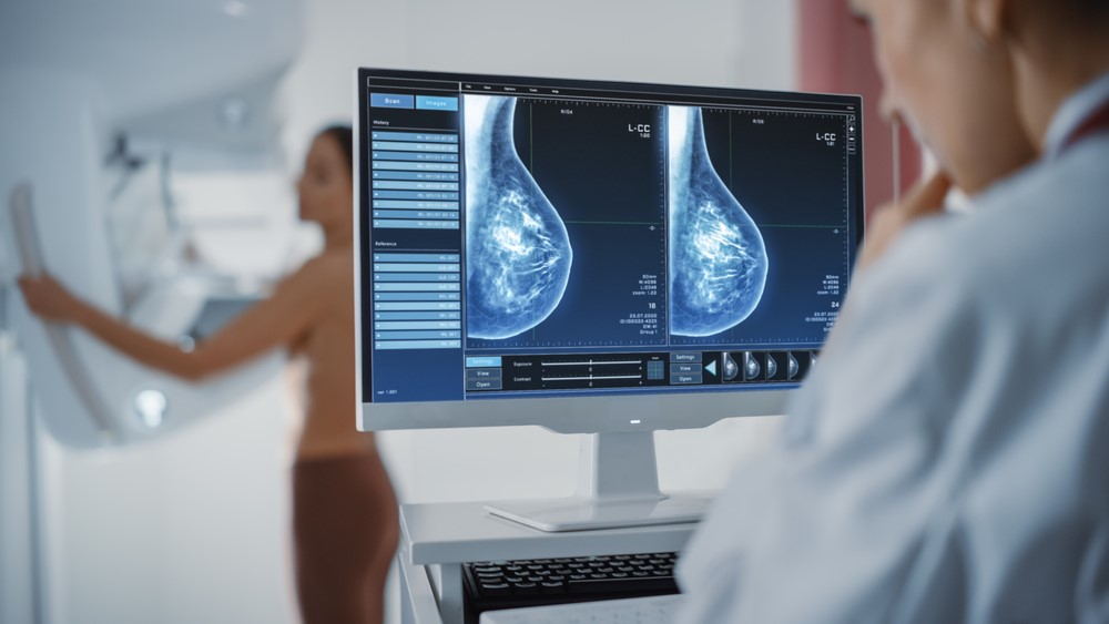 Screening şi diagnostic avansat pentru cancerul mamar, la SANADOR