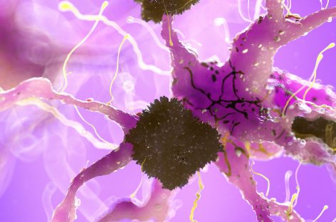 O ciupercă poate pătrunde în creier producând modificări asemănătoare bolii Alzheimer, au descoperit cercetătorii