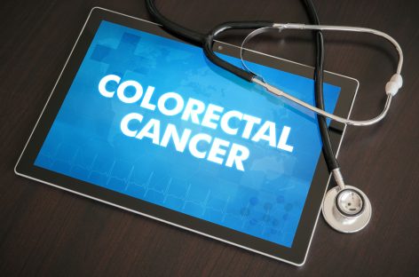 Noi progrese în cancerul colorectal