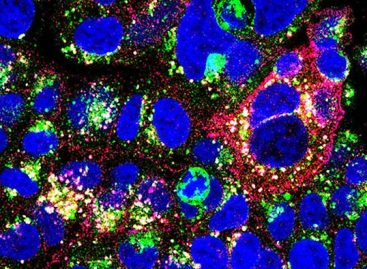 Cancerele de sân, vizate cu un nou anticorp