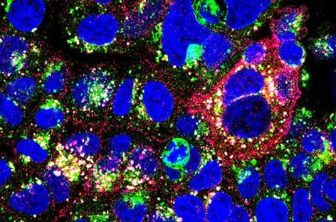 Cancerele de sân, vizate cu un nou anticorp