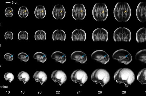 A fost publicat primul atlas digital al dezvoltării creierului fetal uman